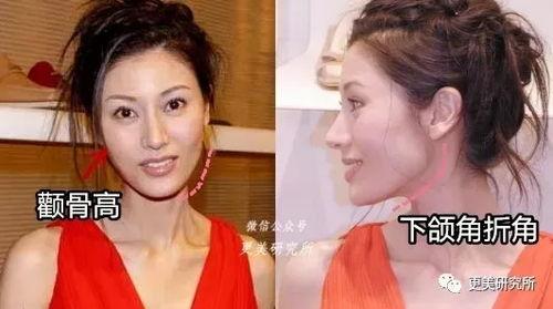 港星爆料大咖整容视频,大咖整容内幕大揭秘 第3张 港星爆料大咖整容视频,大咖整容内幕大揭秘 第3张